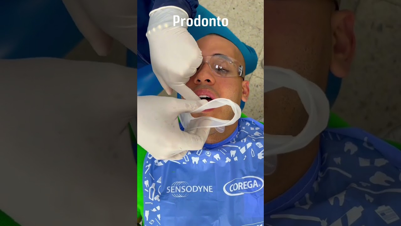 Dica  - Posicionamiento de abrebocas Optragate