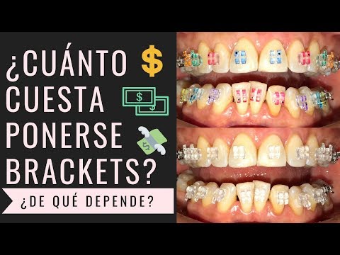 Puedo baratos brackets donde ponerme