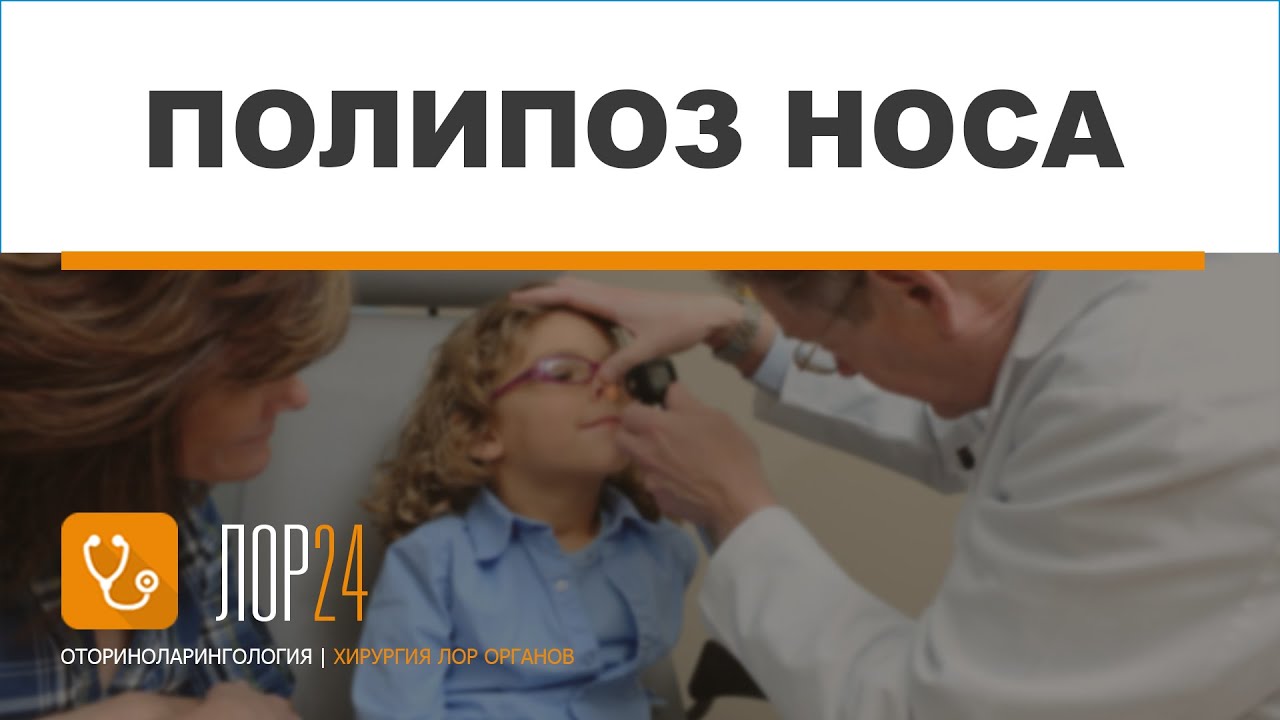 Полипоз носа