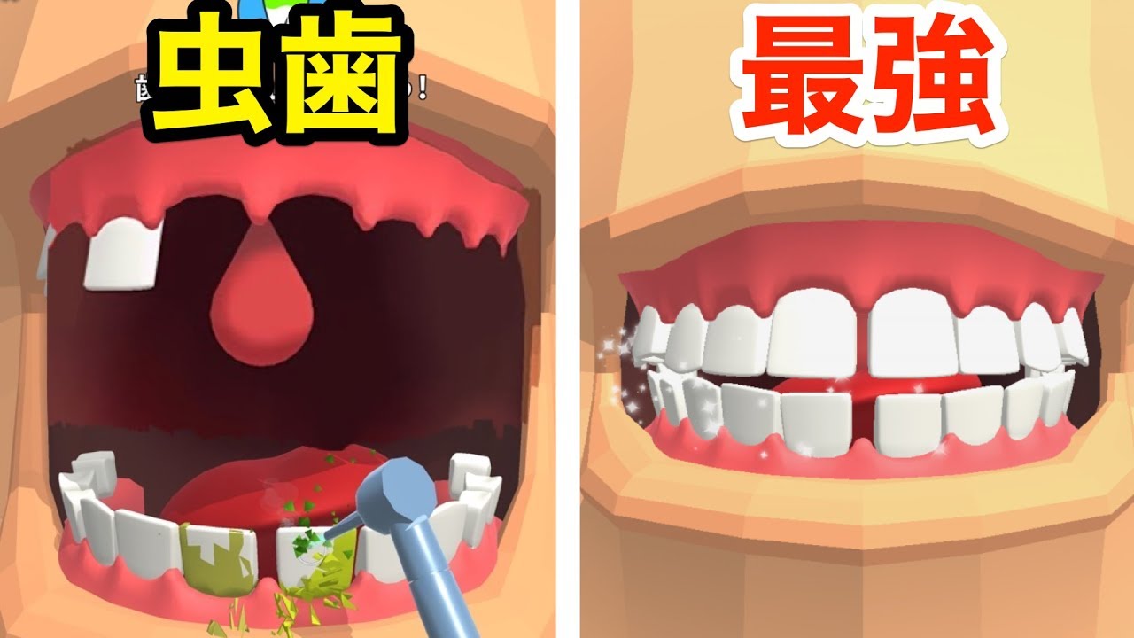 虫歯の歯を雑にひっこ抜くサイコパス歯医者さんゲーム Youtube