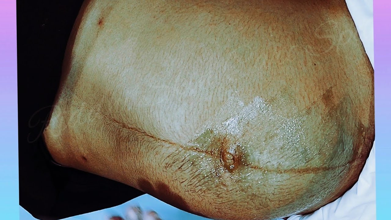 Pregnancy Belly Waxing 9 Months Pregnancy Tummy Waxing pregnancy-belly-waxing-9-months-pregnancy-tummy-waxing