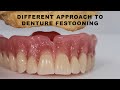 Different Approach to Denture Festooning