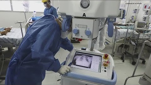 Univ. of Minnesota researchers develop AI algorithm to detect COVID-19 in chest X-rays