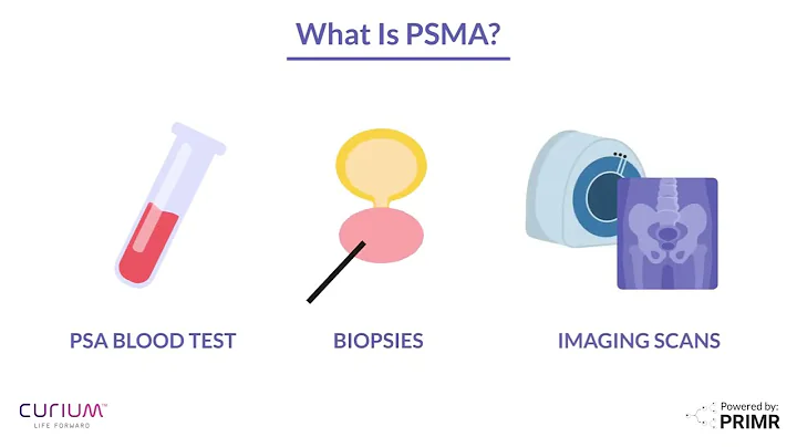 What is PSMA for Prostate Cancer? | PSMA Scans & Targeted Therapy