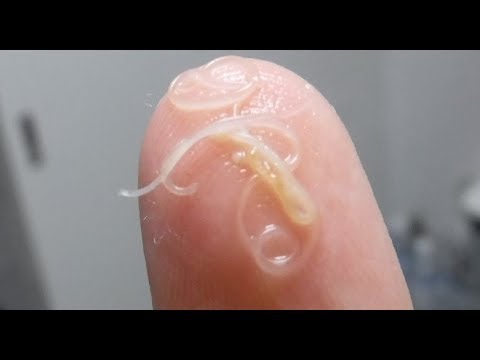 catch cook crab Challenge to Eat a Parasite, Anisakis