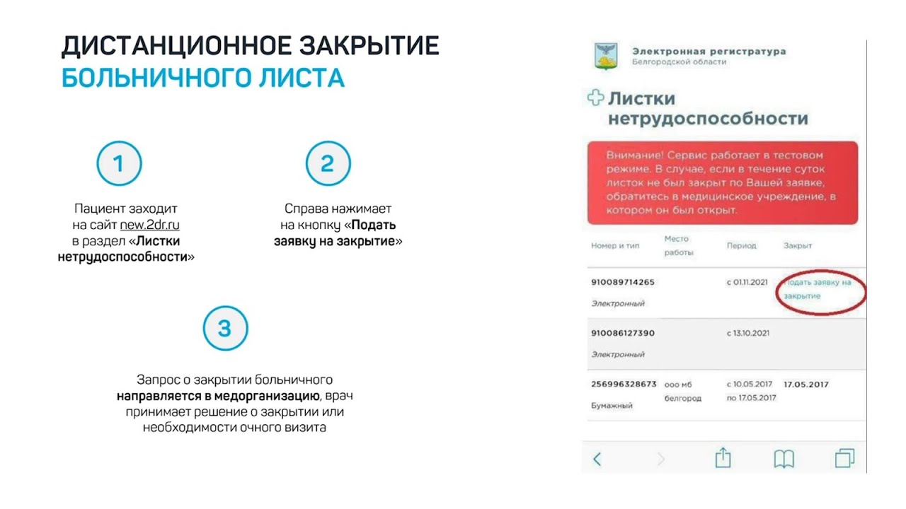 Больничный лист по телефону московская область. Закрыть электронный больничный. Электронный листок нетрудоспособности. Как закрыть электронный больничный лист дистанционно. Закрытый больничный лист электронный.