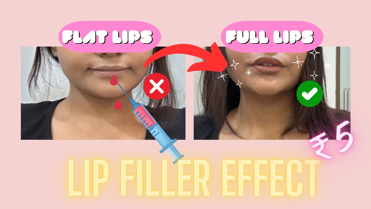 HOW TO GET BIGGER LIPS IN 3 STEPS! FAKE LIP JOB (OMG) - YouTube
