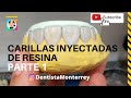 CARILLAS DIRECTAS PASO a PASO 👅Parte 1 Técnica de Inyección #carillasderesina