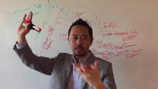 Dr. V Basics: "Possible Complications From Gastric Sleeve Surgery"
