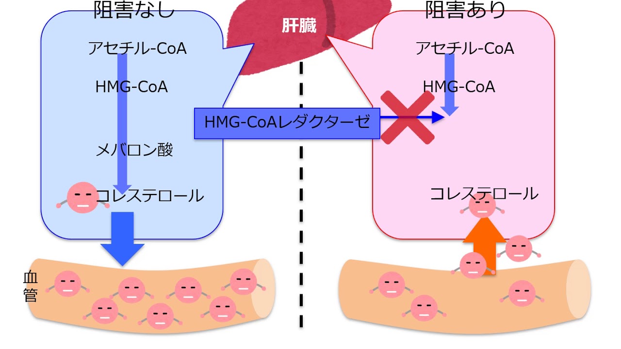 コレステロールを低下させるHMGCoA還元酵素阻害 YouTube コレステロールを低下させるHMGCoA還元酵素阻害 YouTube