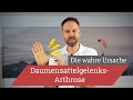 Daumensattelgelenksarthrose - Entstehung und die wahre Ursache