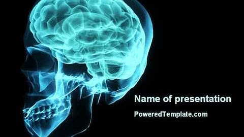 MRT Of Cranial Cavity PowerPoint Template by PoweredTemplate.com