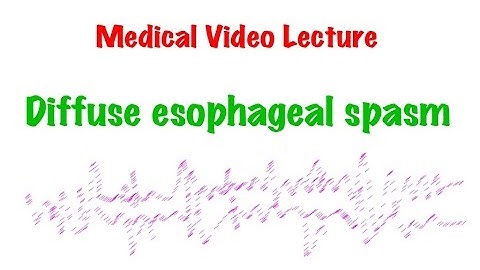 Medical Video Lecture, Surgery: Diffuse Esophageal Spasm (DES)