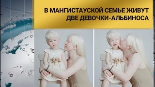 В Мангистауской семье живут две девочки-альбиноса