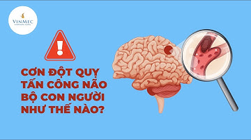 Cơn đột quỵ não tấn công bạn như thế nào?| BS Nguyễn Thị Minh Phương, Bệnh viện ĐKQT Vinmec
