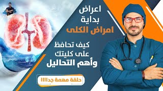 ٢٤٢- صحة الكُلى/ احذر هذه الاعراض واهم التحاليل/دور التغذية للحفاظ عليهم