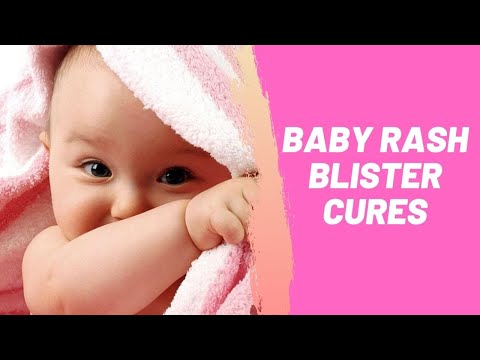 Baby Rash Blister Cures