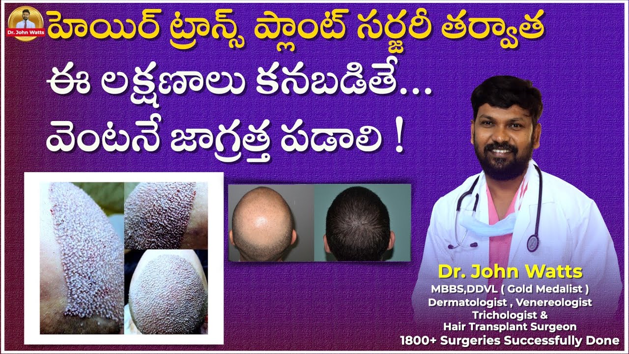 హెయిర్ ట్రాన్స్ ప్లాంట్ సర్జరీ తర్వాత మీరు భయపడేటంత విషయాలేమన్నా ఉన్నాయా?