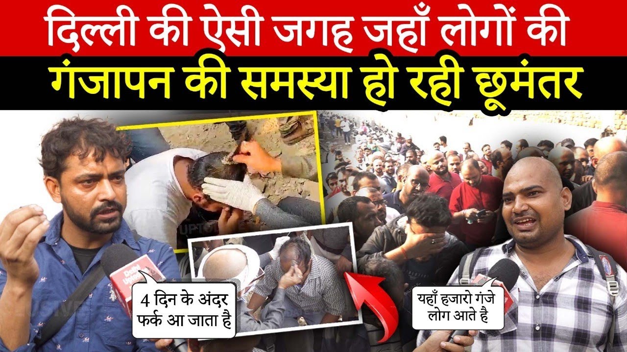 दिल्ली की ऐसी जगह जहाँ लोगों की | गंजेपन की समस्या हो रही छूमंतर | Hair Fall Problem | Delhi News