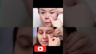 مساج شد بشرة الوجه  Facial skin lift massage