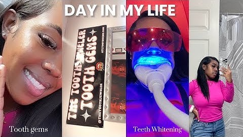 I smile teeth whitening kit review năm 2024