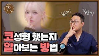 코성형하면 돼지코 안 되나요?
