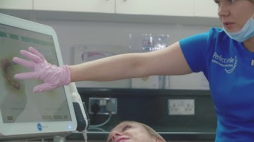 Perfect Smile - Invisalign Itero Scanner