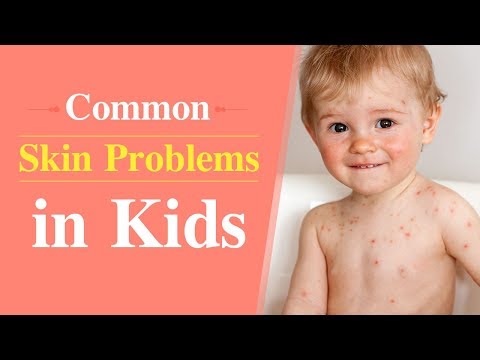 Video: How To Prevent Skin Problems In A Child