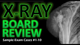 X-Ray Board Review - Sample Exam Cases