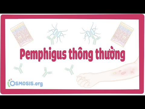 Pemphigus thông thường