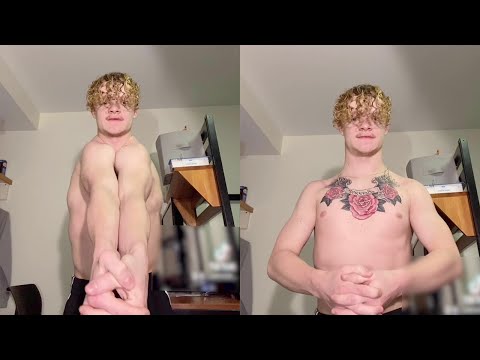 Rare Medical Conditions - Boy without Collarbone Showcases his Flexibility || WooGlobe