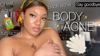 HOW TO GET RID OF BODY ACNE AND GET CLEAR SKIN FROM HEAD TO TOE USING THESE TIPS AND PRODUCTS ✨ screenshot 5