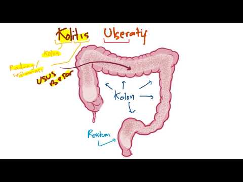 Video: Kolitis Spastik Usus - Gejala, Rawatan