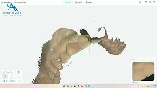 How to Use KP SmileScan Oral Scanner | Pre-Op and Margin Drawing Features Tutorial