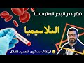 أخطر مرض يسبب فقر الدم التلاسيميا و نقص الحديد المميت