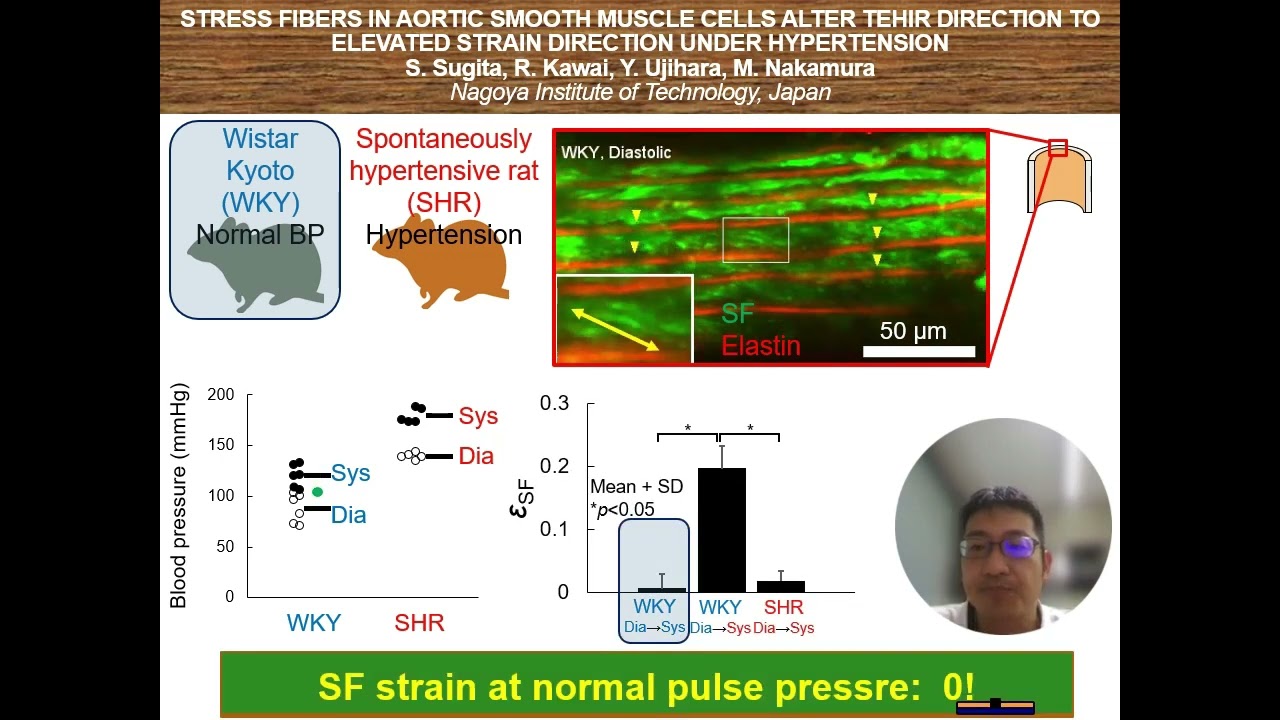 STRESS FIBERS IN AORTIC SMOOTH MUSCLE CELLS ...