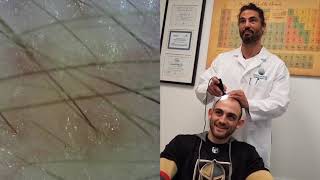 The Dr Takes a Look at Billy's Hair Under the Digital Microscope (With Pictures!) | Stop and Regrow