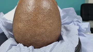 best in London SMP Scalp Micro Pigmentation by El Truchan @ Perfect Definition 20022