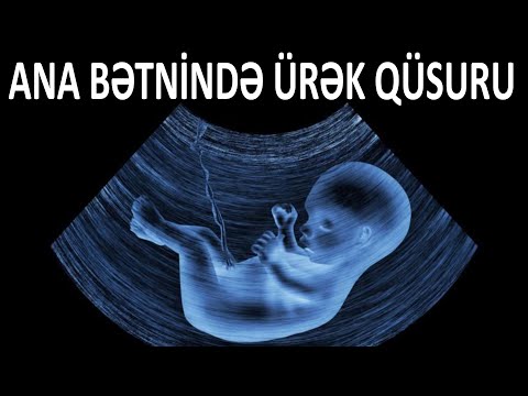 Video: Ürək qızılında kimono qızı haradadır?