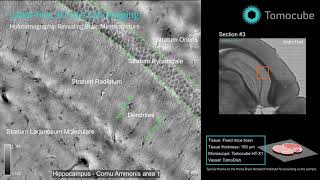 Brain tissue microstructures, taken label-free by the Tomocube HT-X1