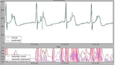 ECG Anomaly Detection experiment with NuPIC (WIP)