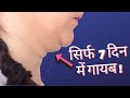 5 Super Easy Exercise to Remove Double Chin Instantly (Hindi)