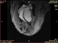 view Cardiac MRI of an animal that has undergone photosynthetic therapy digital asset number 1