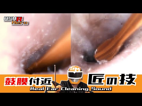 【本物耳かき音ASMR】鼓膜付近はよく取れる/匠の技＋ベビー綿棒 Real Ear Cleaning Sound / SONY ECM-PC60/癒しの耳掃除/イヤースコープ【鼓膜ギリギリシリーズ】