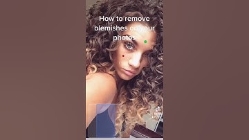HOW TO REMOVE PIMPLES, ACNE, AND BLEMISHES ON YOUR PHOTOS ON YOUR MOBILE DEVICE