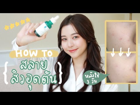 [REVIEW] สลายสิวอุดตันให้หายเกลี้ยง ปังมากก w/La Roche-Posay Effaclar Serum ตัวใหม่! | Babyjingko