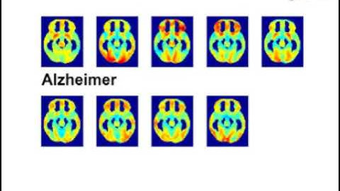 Multivariate analysis fundamentals in neuroimaging data