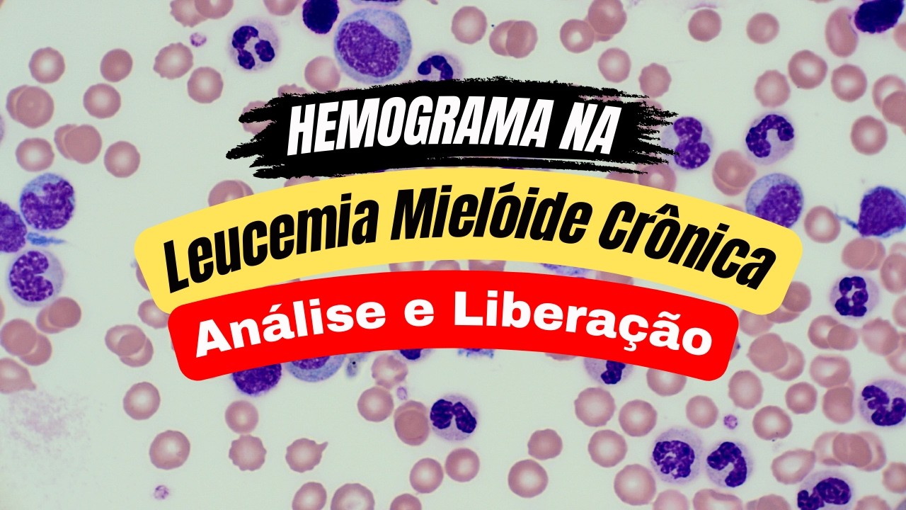 Leucemia Mielóide Crônica - morfologia, análise, liberação e entendimento