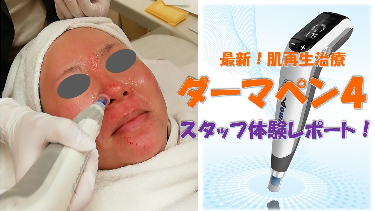 ダーマペン4 大阪のツツイ美容外科 美容皮膚科 心斎橋