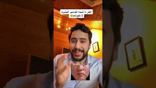 اكتر ٥ أشياء لتدمير البشرة🤩 | دكتور يوسف screenshot 3